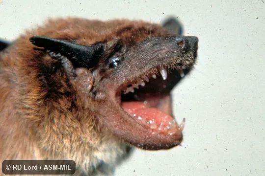 Male, close-up view with mouth open, teeth exposed